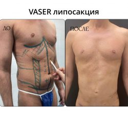 Посмотреть