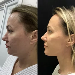 Посмотреть