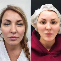 Посмотреть