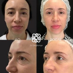 Посмотреть