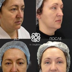 Посмотреть