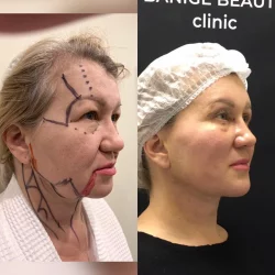 Посмотреть